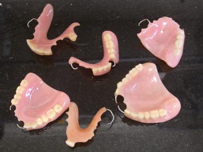 Acrylic Partial Dentures - Dental Prosthetics Design Studio